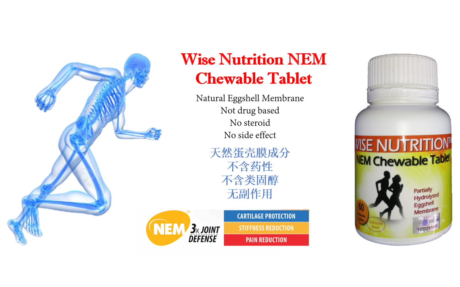 NEM